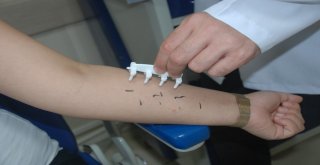 Alerjik Nezlede Yeni Nesil Test