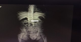 Bak Şu Yaramazın Yaptığına