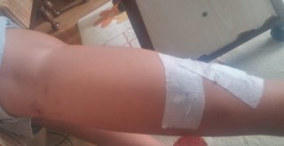 İnegölde Başı Boş Köpekler Dehşet Saçmaya Devam Ediyor