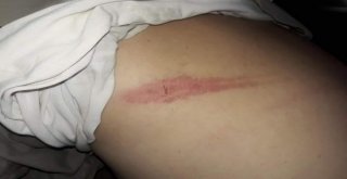 Rakka Halkından Pkk/pydnin İşkencelerine Karşı Protesto