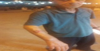 Evinden Çıkarken 6 Köpeğin Saldırısına Uğrayan Adam Hastanelik Oldu