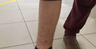 Kurban Kesilirken Ayağına Kene Yapıştı