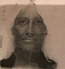 Alanyada Turist Kadın 5İnci Kattan Düştü